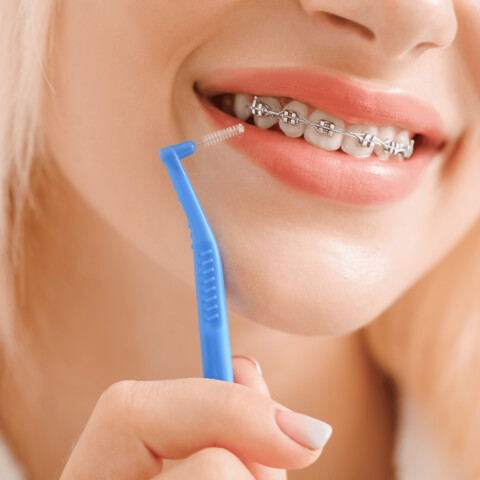 kobieta w aparacie ortodontycznym czyszcząca zęby 